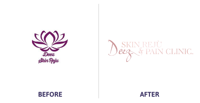 Deez Skin Reju Logo before and after